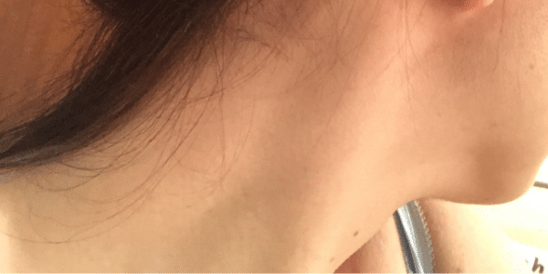 冷やすなら動脈